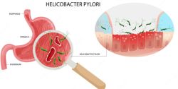 Helicobacter Pylori Treatment